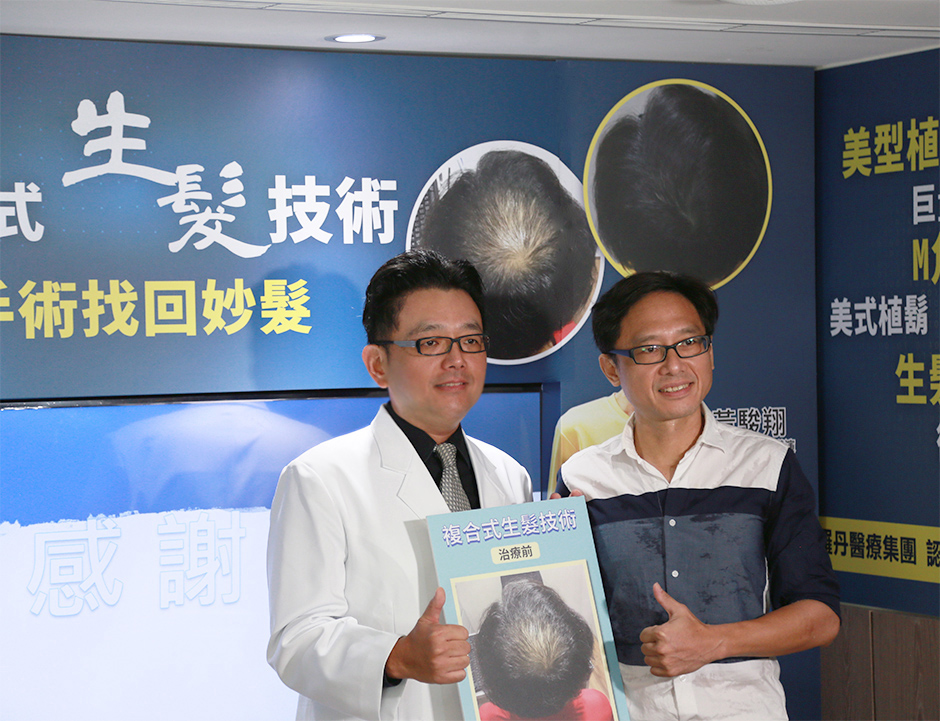 植髮 生髮  掉髮 禿頭